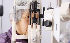 Kiểm tra mắt giúp phát hiện bệnh Alzheimer sớm