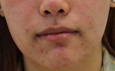 7 dấu hiệu 'tố cáo' bạn không được khỏe mạnh