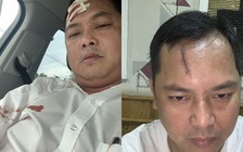 Vụ gây rối trật tự ở Biên Hòa: Nạn nhân bị đánh rách trán nói gì ?