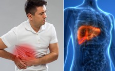 5 dấu hiệu 'tố cáo' ung thư đại trực tràng đã di căn đến gan