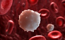 9 dấu hiệu 'tố cáo' bạn có thể mắc bệnh ung thư máu