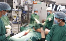 Nạn nhân bị cây dầu bật gốc đè ở TP.HCM đã tử vong