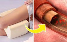 Ngủ theo cách này, lợi ích đủ đường