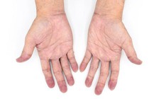 Nhiễm Omicron: Gặp triệu chứng này, hãy gọi cấp cứu