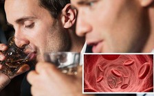 Cục máu đông: Dấu hiệu báo trước ở hàm và vai