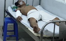 Nổ thiết bị ở nhà máy gạch, 4 công nhân bị bỏng nặng