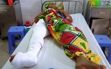 Cán bộ xã bị bánh xe ben của 'cát tặc' cán qua chân