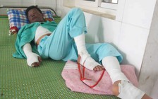 Chơi game trong lúc sạc điện thoại, điện thoại phát nổ khiến nam thanh niên bỏng nặng