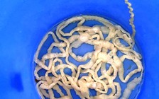 Hai mẹ con bị sán xơ mít dài 8 mét ký sinh trong cơ thể 2 năm