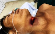 Cứu sống kịp thời người đàn ông dùng rựa cắt cổ tự tử