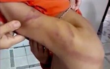 Quảng Nam: Đề xuất xử phạt người cha có dấu hiệu bạo hành con ruột