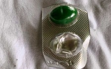 Nữ bệnh nhân ‘lơ đãng’ nuốt cả vỉ kẽm 2 viên thuốc, phải phẫu thuật gắp ra