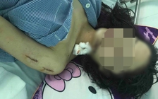 Hai cô gái trẻ dùng dao, kéo rạch mặt nhau chỉ vì mâu thuẫn nhỏ