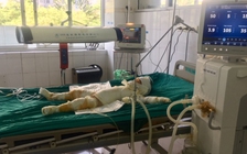 Vụ đốt nhà người tình vì mâu thuẫn tình cảm: Thêm một nạn nhân tử vong