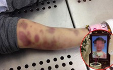 Khởi tố vụ án bé gái 3 tuổi tử vong nghi bị mẹ và cha dượng bạo hành