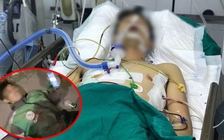 Vẫn chưa bắt được 2 nghi phạm đâm tài xế GrabBike trọng thương, cướp tài sản