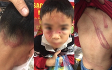 Hà Nội truy vết người vu khống công an làm ngơ cho bố bạo hành con nhỏ