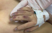 Vụ bé gái 6 tuổi ở Hà Nội tử vong: Bị bố đánh bằng thanh tre, cán chổi