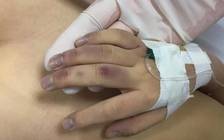 Người bố đánh con gái dẫn tới tử vong lãnh án hơn 7 năm tù