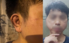 Chủ quán lẩu nướng thừa nhận đã đánh hội đồng nhân viên vì xin nghỉ việc