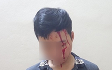 Con trai dựng màn kịch bị đánh đập để tống tiền mẹ ruột