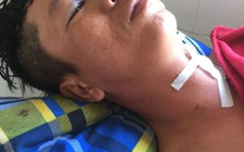 Vào tận bệnh viện truy sát: Khởi tố, bắt tam giam 3 người