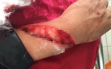 Cà Mau: Chém vợ 'hờ' rồi bỏ trốn vào rừng