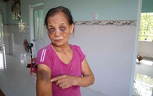 Vụ con dâu đánh mẹ chồng bầm tím mắt: Xin lỗi mẹ chồng tại công an xã