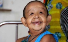 Bé trai 4 tuổi mắc chứng bệnh bí ẩn trông như ông lão