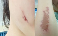 Một nữ sinh bị đánh trong phòng nội trú