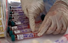 Tình hình Covid-19 ngày 10.8 tại TP.HCM: Người khai báo y tế gia tăng