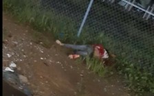 Nối thành công hai cổ tay nạn nhân bị chém đứt lìa ở Đồng Nai