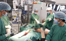 Cây dầu bật gốc đè người đi đường ở TP.HCM: Nạn nhân chấn thương rất nặng