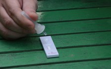 Tin tức Covid-19: Vì sao TP.HCM phát hiện 'kỷ lục' 8.499 ca nhiễm trong ngày 3.9?