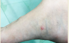 Tình hình các loại dịch bệnh mới nhất tại TP.HCM