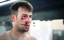 Cua rơ Mark Cavendish khởi đầu năm 2018 quá đen đủi