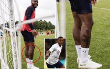 CĐV Anh đòi trục xuất Sterling khỏi tuyển Anh vì xăm hình khẩu súng