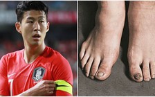 Son Heung-Min và hệ quả cho suất miễn nghĩa vụ quân sự Hàn Quốc