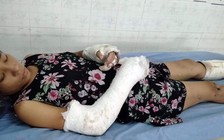 Khởi tố gã 'chồng hờ' đánh thai phụ dã man