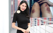 Ca sĩ Thủy Tiên ngã chấn thương khi tập vũ đạo