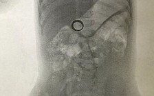 Nhẫn cưới trong bụng con trai