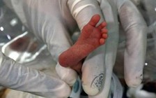 Vụ 'bé sơ sinh suýt bị chôn sống': Kỷ luật các y, bác sĩ