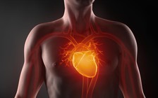 Bạn biết gì về mỡ trong máu?