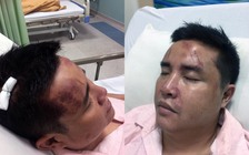 Bị đánh bầm dập ở quán bar