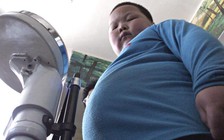 Bé trai thừa cân chịu rủi ro ung thư ruột kết tăng cao lúc lớn