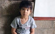 Bé gái sống lay lắt vì đa dị tật bẩm sinh