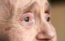 Caffeine không giúp cải thiện sự cơ động của bệnh nhân Parkinson?