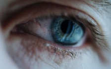 Khôi phục ý thức cho bệnh nhân thực vật