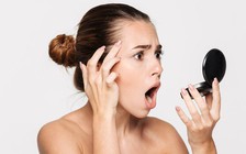 10 lý do bất ngờ khiến da mặt bạn nổi mụn