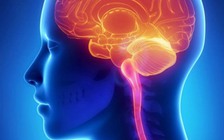 Cần biết về đột quỵ - 'kẻ giết người thầm lặng'